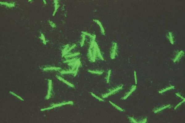 IFA Clostridium piliforme